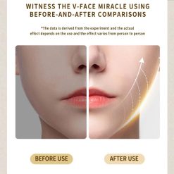 Alternative view of Intelligent Electric Double Chin and V-Shaped Face Machine with 12Adjustable Intensities - Women's V-Face Machine(white,25.6*4.5cm）
