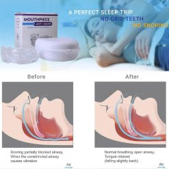 Alternative view of Anti-snoring device adjustable mouthguard